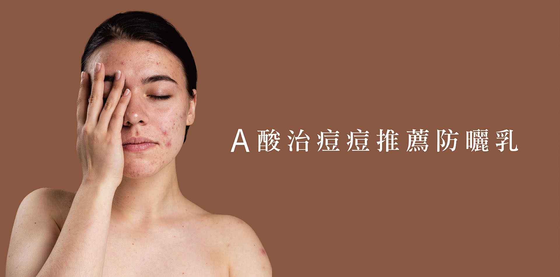 A酸煥膚適合的防曬乳、保養品怎麼選？敏感肌、痘痘肌最佳解